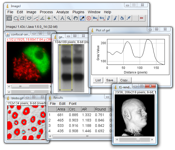 ImageJ measure lengths in Pixels